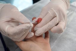 В Воронежской области заболеваемость ВИЧ за год снизилась на 6,7 процента