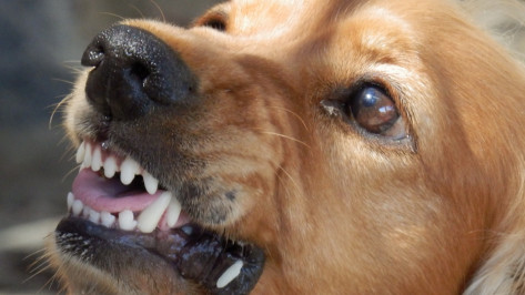 В центре Воронежа бродячая собака прокусила ногу 58-летней женщине