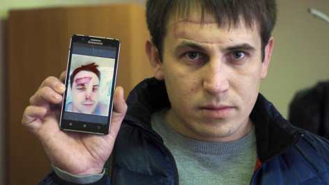 Воронежец получил 3 года условно за откушенный на корпоративе нос инженера 