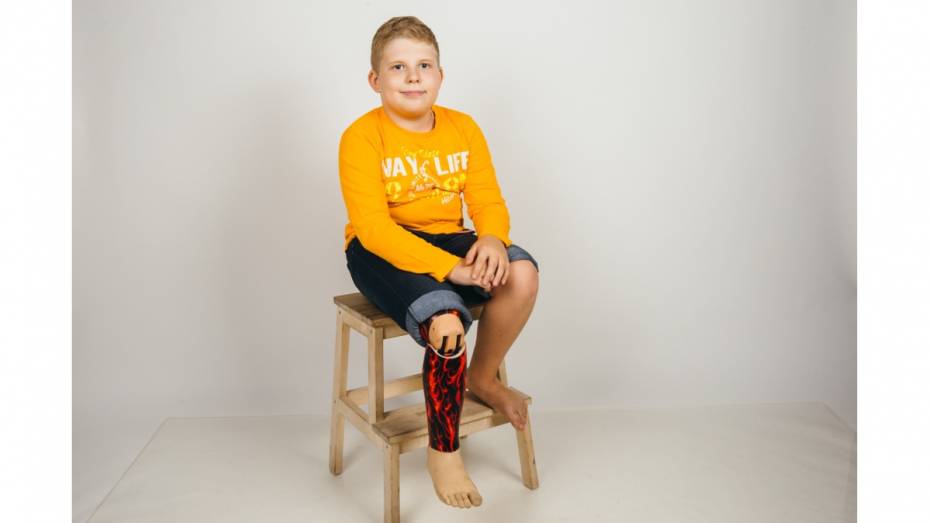 Американские врачи бесплатно поставили протез 10-летнему герою РИА «Воронеж»