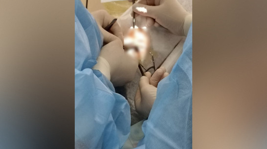 Воронежские врачи вылечили мужчину, 20 лет страдавшего от косоглазия