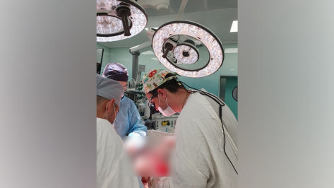 Воронежские онкологи удалили опухоль слепой кишки у белгородского пенсионера