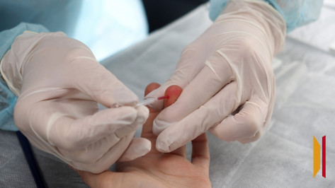 Воронежцев приглашают пройти бесплатное тестирование на гепатит и ВИЧ в парке «Орленок»