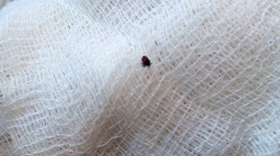 Клещи заразили болезнью Лайма 3 жителей Воронежской области