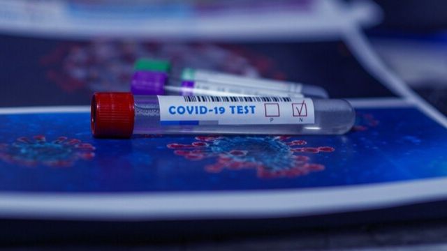 В Воронеже за отсутствие тестов на ковид у детей оштрафовали их мать