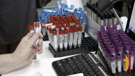 Воронежские военнослужащие будут сдавать биоматериал для ДНК-теста