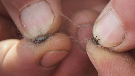 Более 150 воронежцев за неделю обратились к медикам с укусами клещей