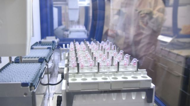 Сибирскую язву выявили в трех пробах, взятых в селе Лебединка Воронежской области