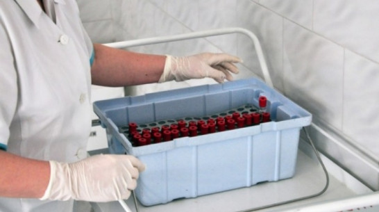 Федеральная лаборатория Роспотребнадзора не подтвердила коронавирус у 2 воронежцев