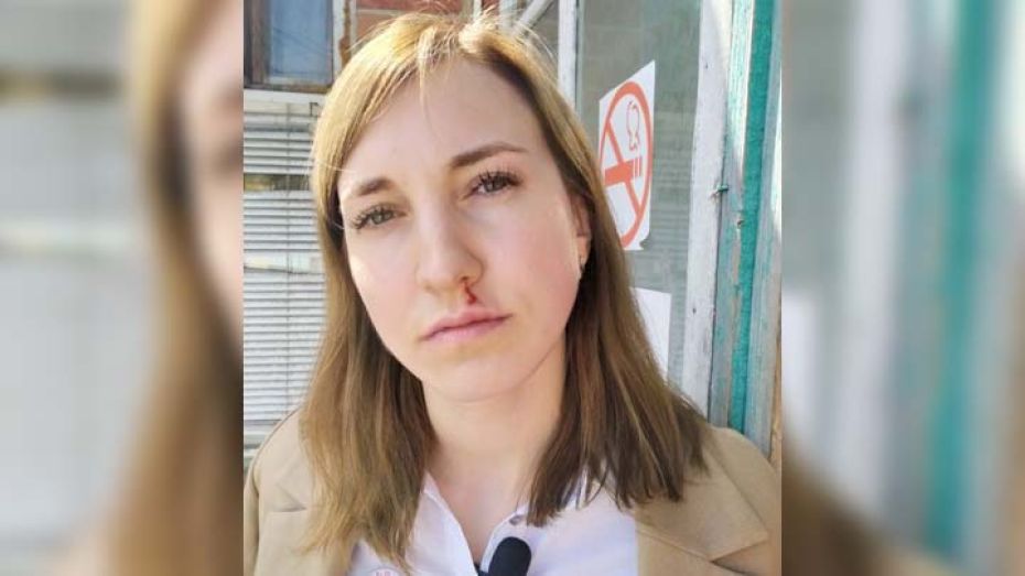 Представителю профсоюза медиков в больнице в Воронежской области расцарапали лицо