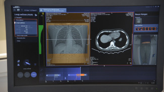 В воронежской детской больнице установят ультрасовременный компьютерный томограф