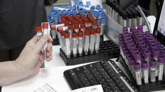 Первый случай заражения оспой обезьян зафиксировали в России