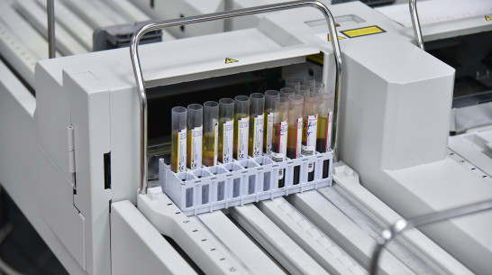 В Воронежской области выявили 51 новый случай COVID-19