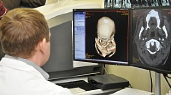 В Воронеже ветераны Великой Отечественной войны могут бесплатно пройти компьютерную томографию 