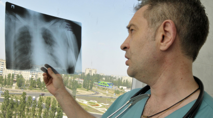 Заболеваемость активным туберкулезом выросла в Воронежской области почти на 30%
