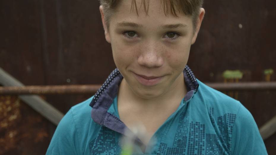 «Не хочу быть Квазимодо». Русфонд попросил о помощи для подростка из Воронежcкой области