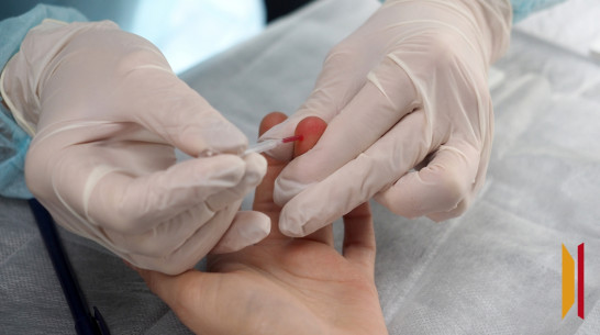 В Воронежской области за 2025 год ВИЧ заразились около 260 человек