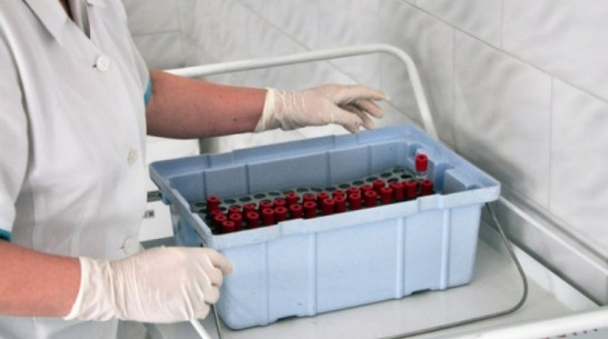 «Вирус способен мутировать». Нужно ли воронежцам бояться птичьего гриппа