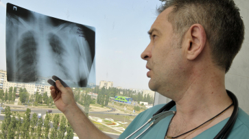 Заболеваемость активным туберкулезом выросла в Воронежской области почти на 30%