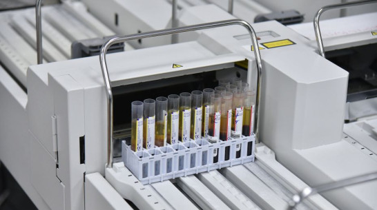 Свыше 100 случаев ковида зафиксировали в Воронежской области