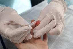Заболеваемость ВИЧ выросла в Воронежской области