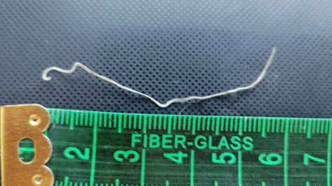 В Воронеже у женщины в руке после укуса комара поселился червь