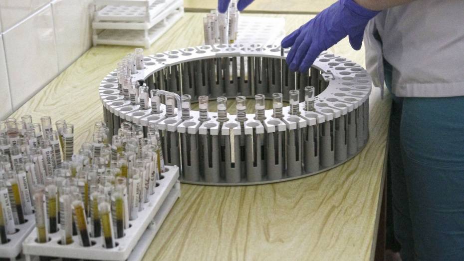 Еще у 34 человек в Воронежской области нашли коронавирус