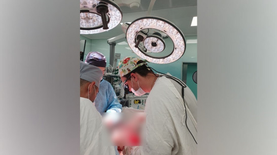 Воронежские онкологи удалили опухоль слепой кишки у белгородского пенсионера