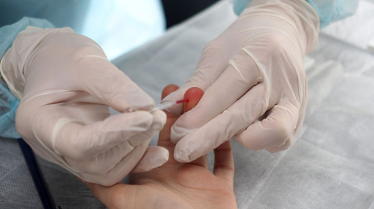 Воронежцы смогут сдать анализ на ВИЧ без предварительной записи