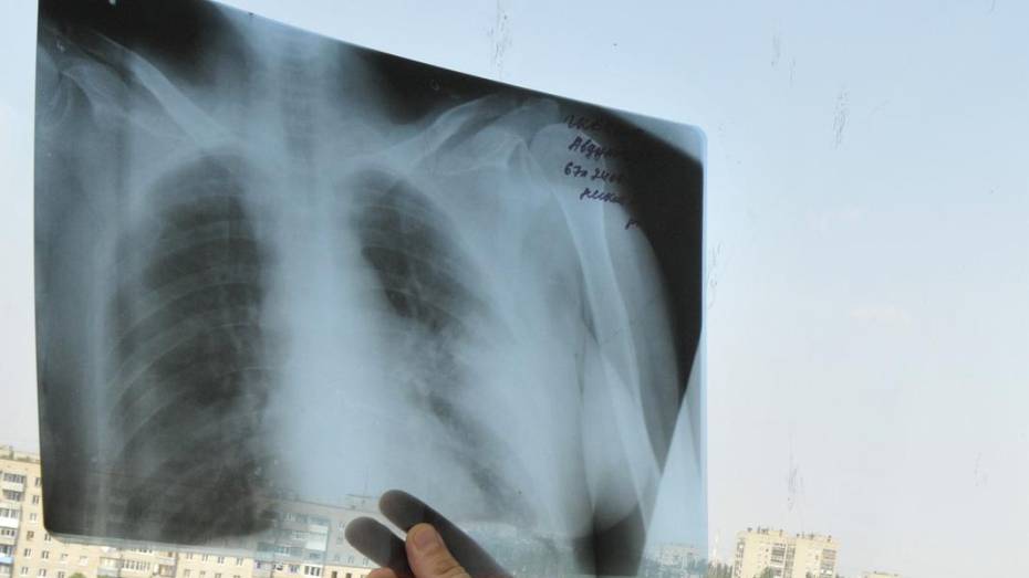 В 10 воронежских медучреждениях заработала единая база для хранения рентгеновских снимков 