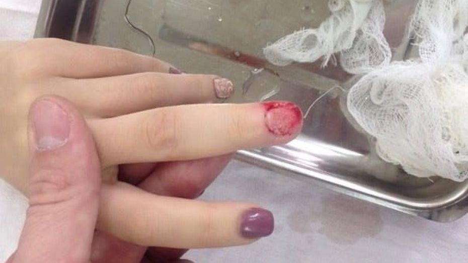 Следователи проверят салон красоты из-за удаления ногтей у воронежской модели 