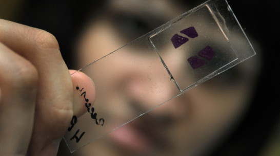 Санврачи опробовали снюсы из воронежских магазинов на крысах