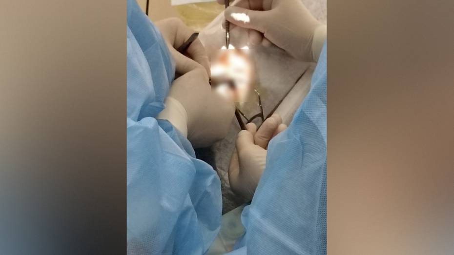 Воронежские врачи вылечили мужчину, 20 лет страдавшего от косоглазия