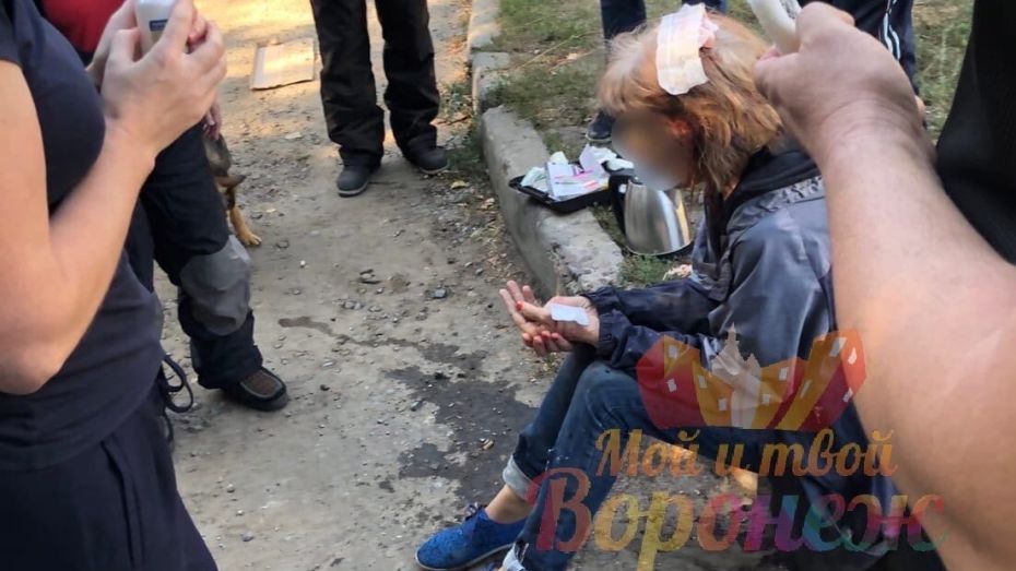 Стая бездомных собак напала на женщину в Коминтерновском районе Воронежа