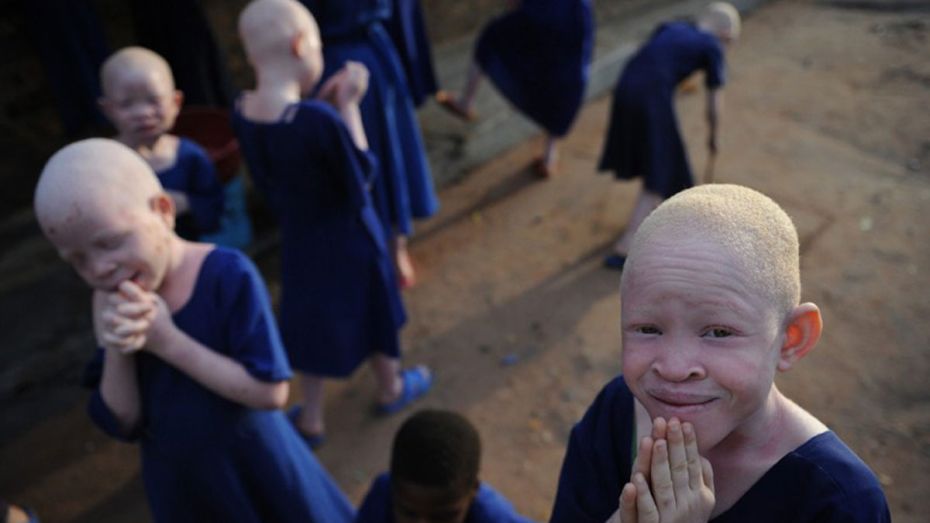 ООН выступила против ритуальных убийств танзанийских альбиносов