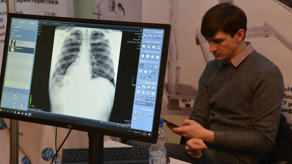 Рентген-аппараты закупят в 8 воронежских медучреждений за 100 млн рублей
