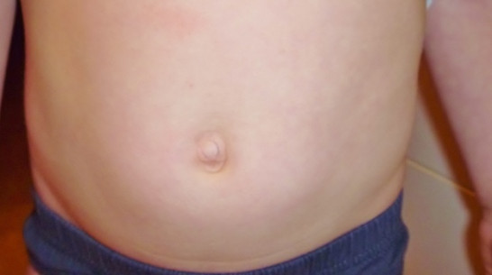 В Бобровском и Лискинском районах отмечается всплеск кишечных заболеваний