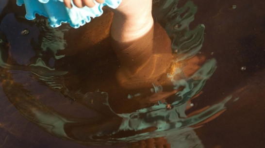 В водоемах Воронежской области энтеровирусной инфекции, вызывающей менингит, не обнаружено