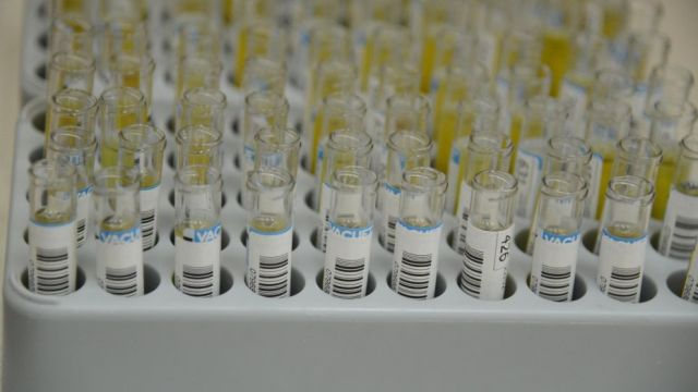 Воронежцам рассказали о рисках заболевания новым смертельным вирусом