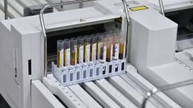 Сибирскую язву подтвердили у 5 воронежцев