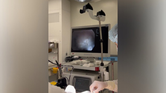 Воронежские врачи удалили пациенту растущую наружу опухоль горла размером 2 см