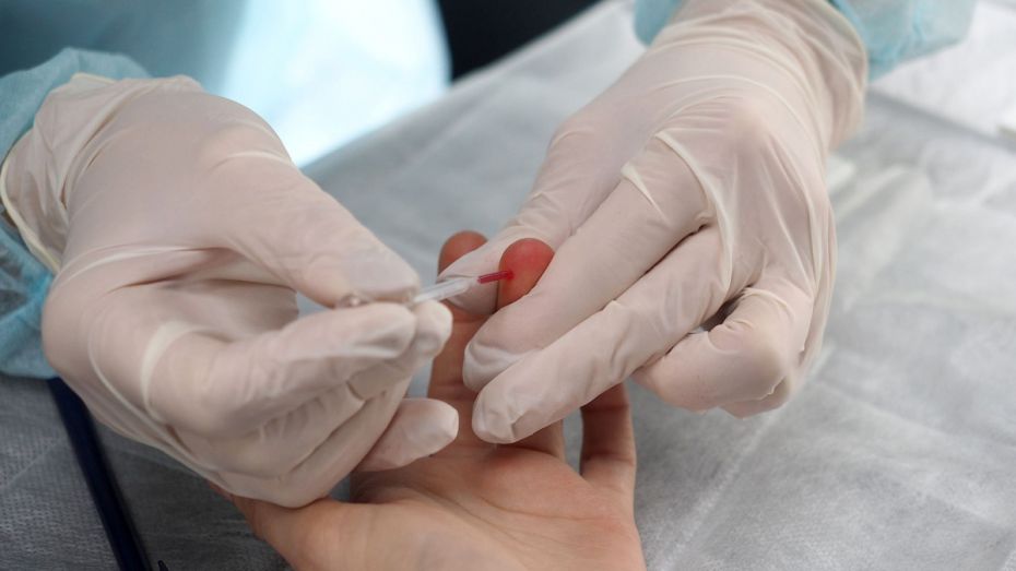 Больше 300 новых случаев ВИЧ выявили за 8 месяцев в Воронежской области