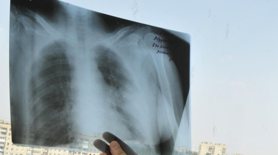 В 10 воронежских медучреждениях заработала единая база для хранения рентгеновских снимков 