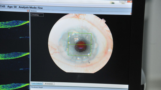 Воронежские хирурги впервые провели кераринг