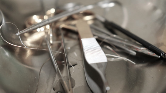 Повторившую опасный ролик из TikTok девочку спасли воронежские хирурги