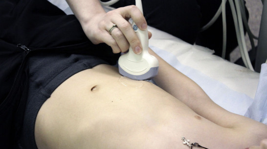 В Воронеже в детской больнице появился экспертный УЗ-сканер 