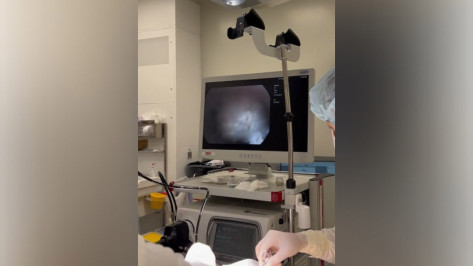 Воронежские врачи удалили пациенту растущую наружу опухоль горла размером 2 см