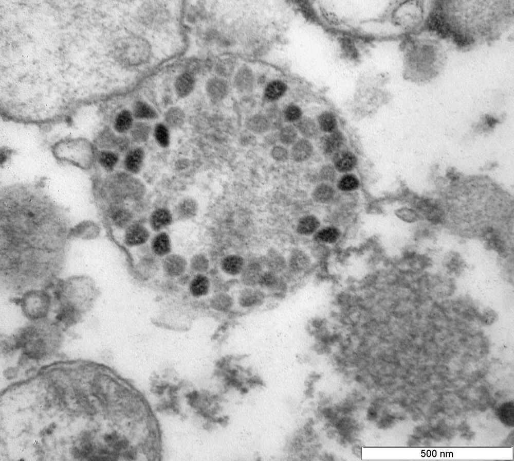 Вирусные частицы разнообразной формы в пузырьках клеток Vero Е6