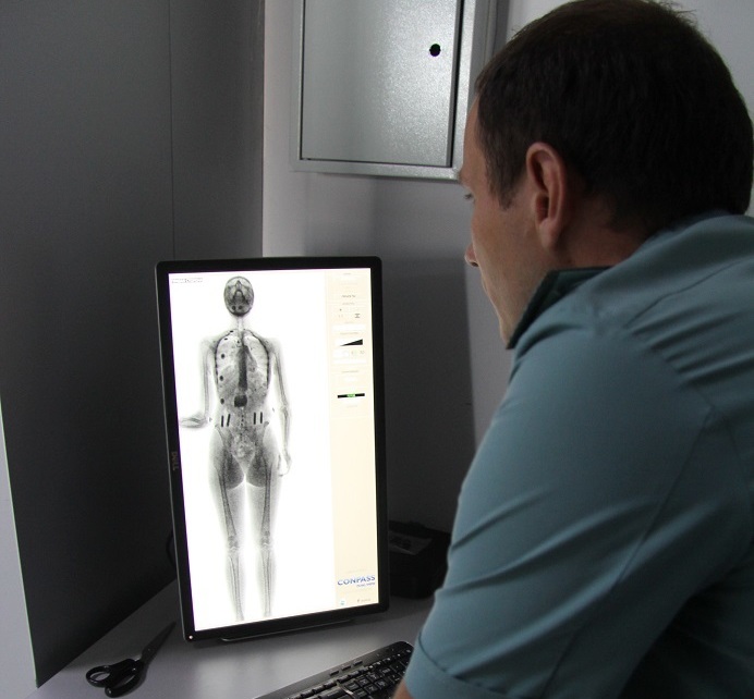 Сканер в телефоне реалми. Рентген-сканер 2xr51. Рентгеновский сканер в аэропорту снимки. Цифровой рентгенографический сканер для персонального досмотра. Рентгеновский сканер «Homoscan».