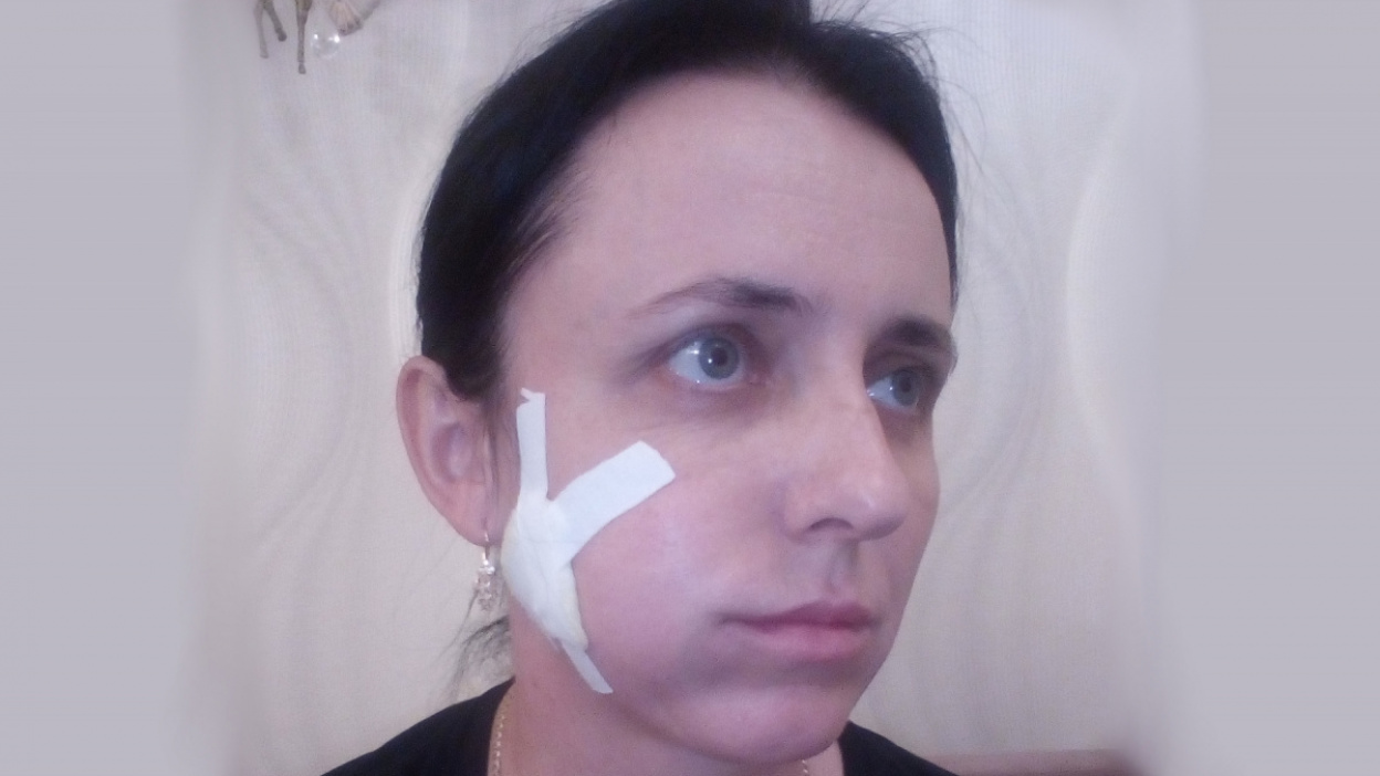 пройтись щека